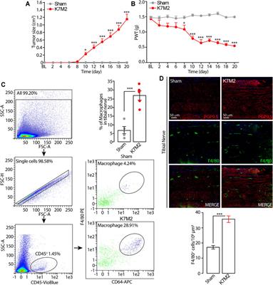 β2-and β3-Adrenergic Receptors Contribute to Cancer-Evoked Pain in a Mouse Model of Osteosarcoma via Modulation of Neural Macrophages